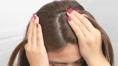 كيفية علاج قشرة الشعر: 4 وصفات منزلية للتخلص من أكثر المشكلات المزعجة