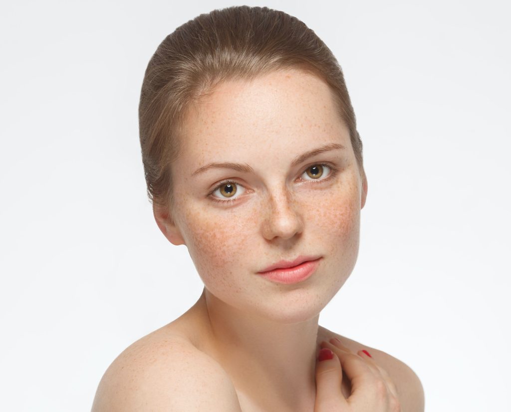 كيفية إزالة نمش الوجه والجسم: 5 خضراوت للتخلص من البقع البنية ؟