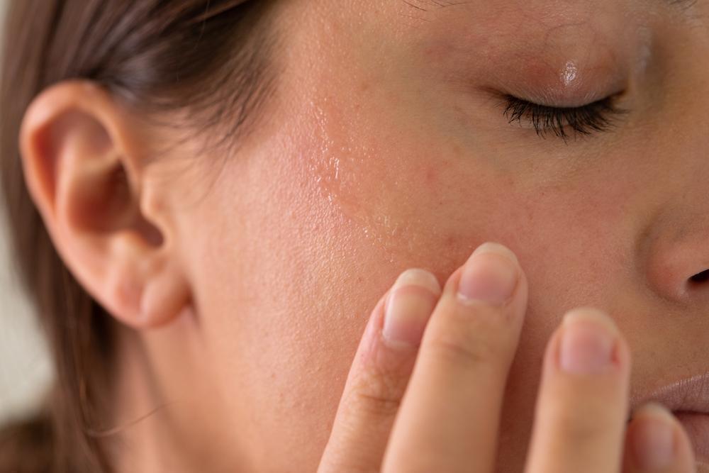 العوامل المؤثرة على جفاف الوجه